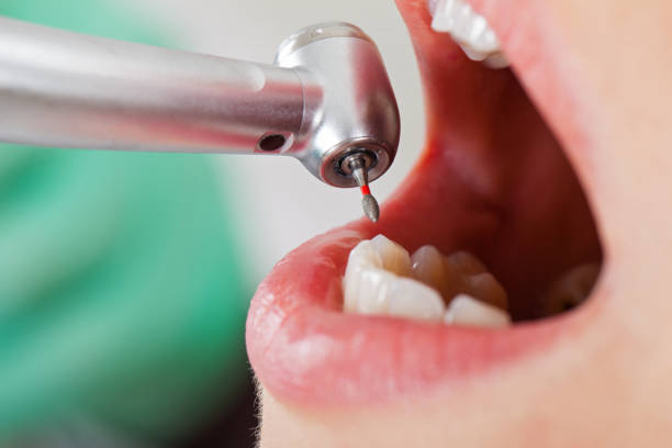 Best Tooth Pain Emergency Relief  in Yorkshire, VA